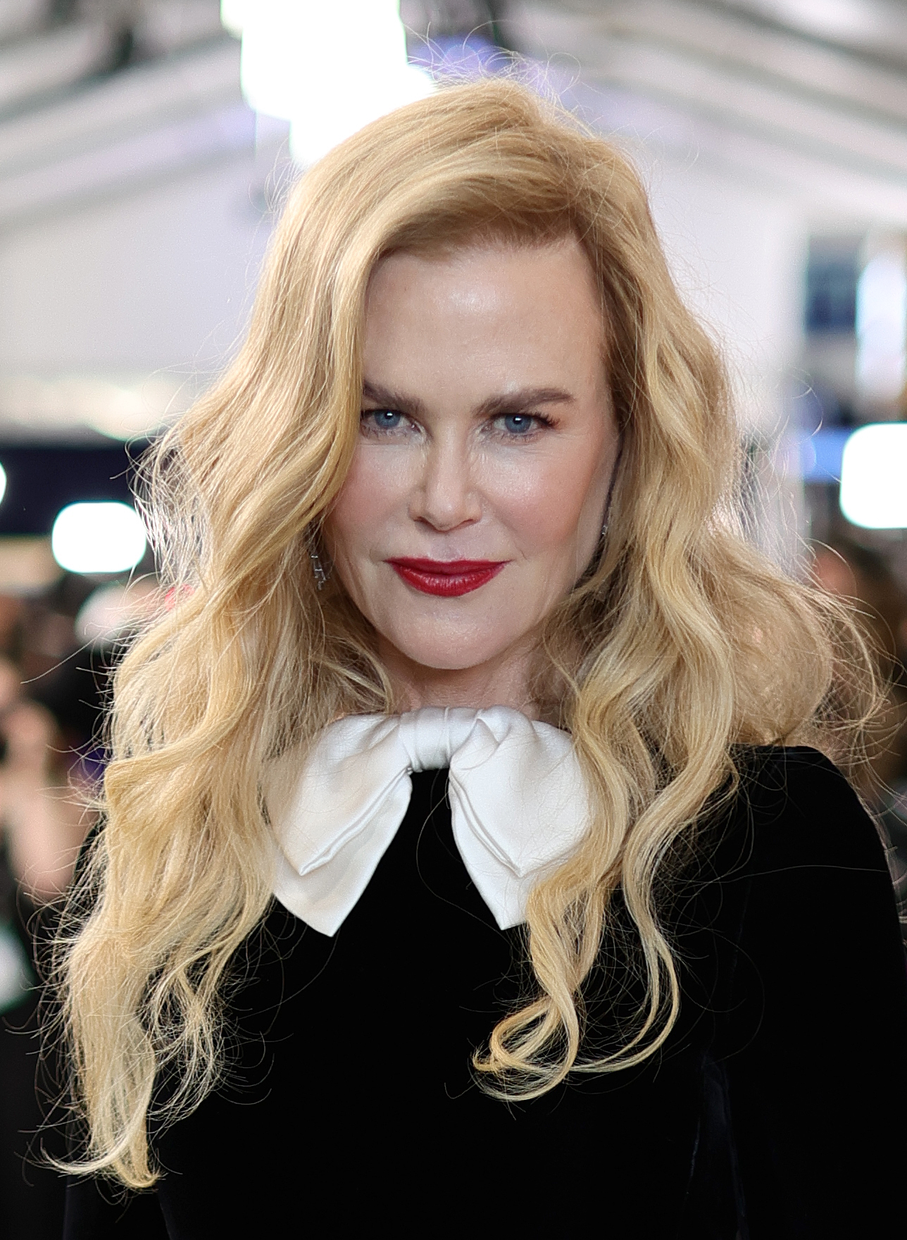 At the 2022 Screen Actors Guild Awards, her complexion was intensely smooth and taut, featuring an entirely line-free forehead and prominently filled, rounded cheeks. The ultra-polished look firmly maintained her long-standing, heavily managed aesthetic.