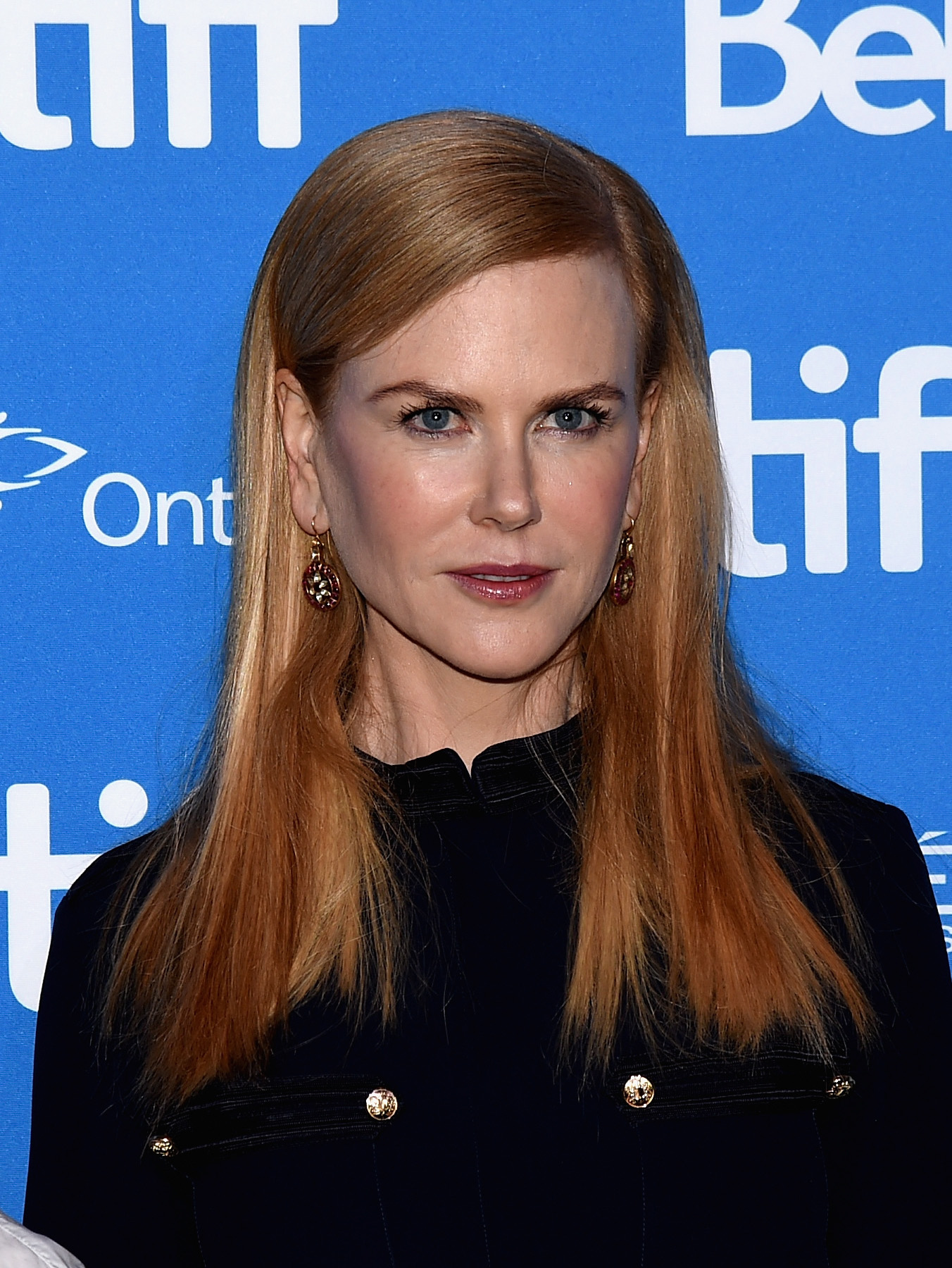 Kidman's appearance at the September 2016 "Lion" press conference showed a return to a noticeably taut, heavily smoothed aesthetic. The line-free brow and distinct fullness in her cheeks made it clear that the public speculation surrounding cosmetic enhancements was far from over.