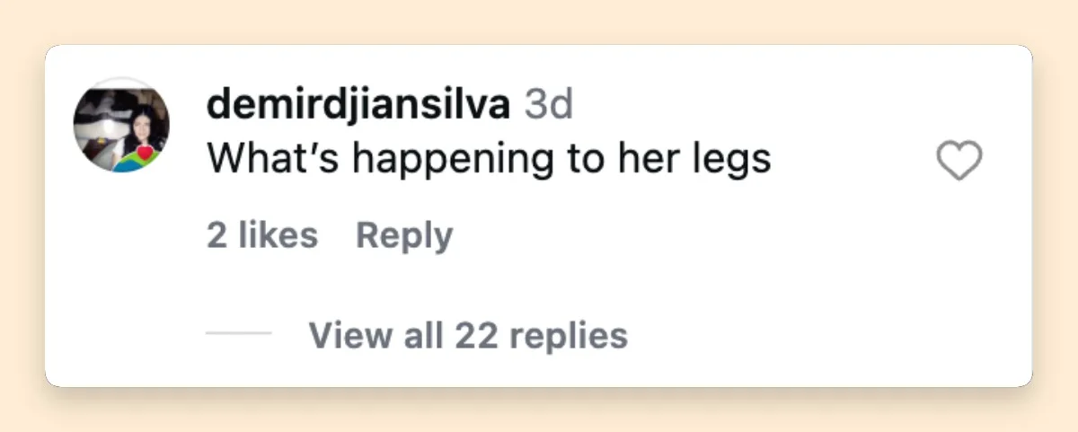 The focus on Griffith's legs quickly became one of the biggest talking points around the latest photos. One commenter asked directly, "What's happening to her legs," underscoring how intensely her appearance was being scrutinized.