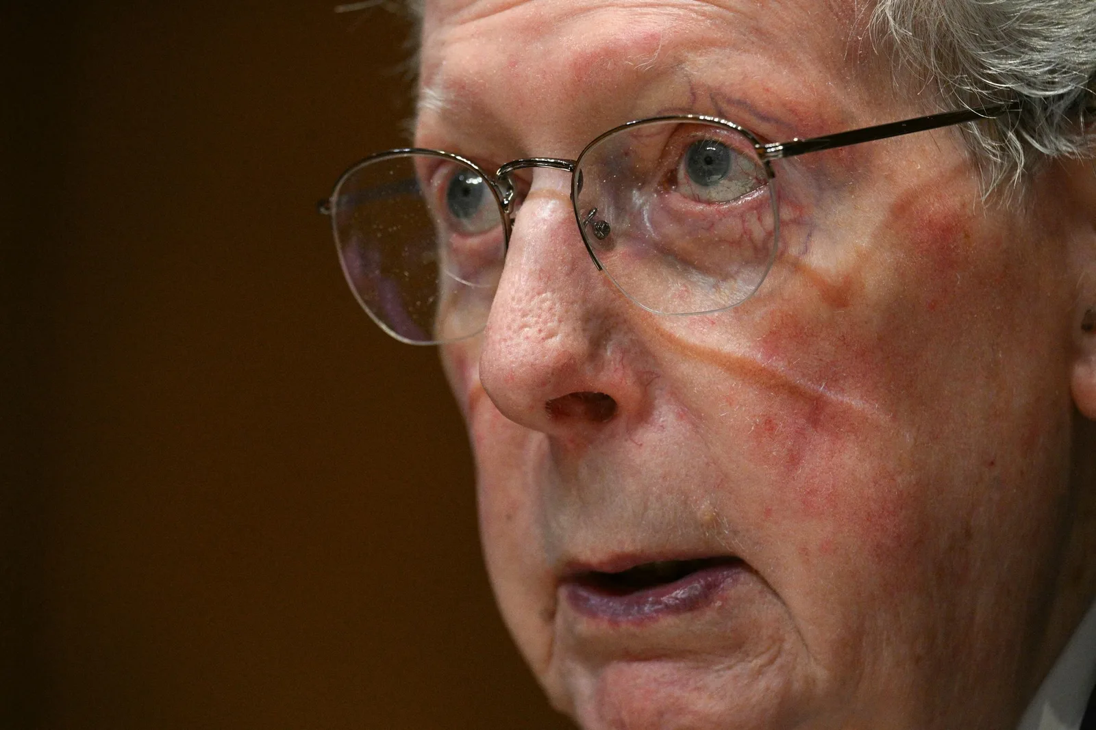McConnell insisted he suffered no broken bones, concussions, strokes, tumors, or hemorrhages. He stated that he was continuing his work remotely on appropriations and midterm politics before his upcoming January retirement.